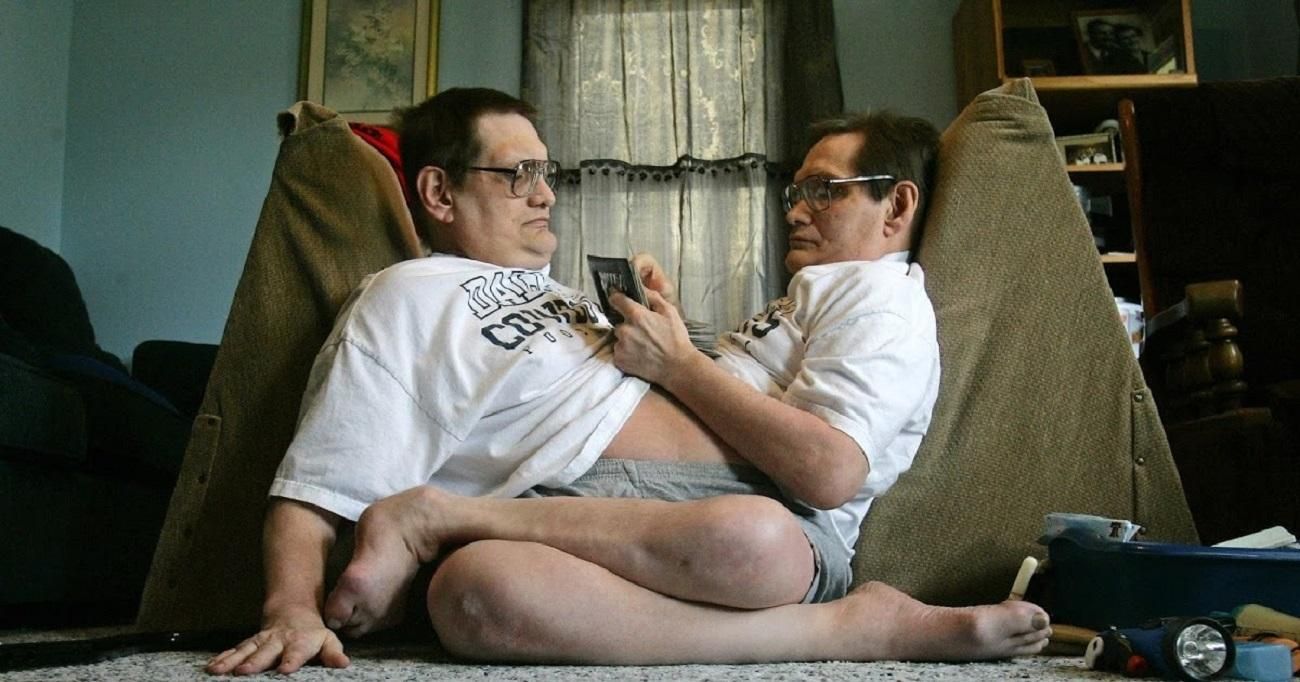 Умерли самые старые сиамские близнецы Ронни и Донни Гейлоны Умерли самые старые сиамские близнецы Ронни и Донни Гейлоны