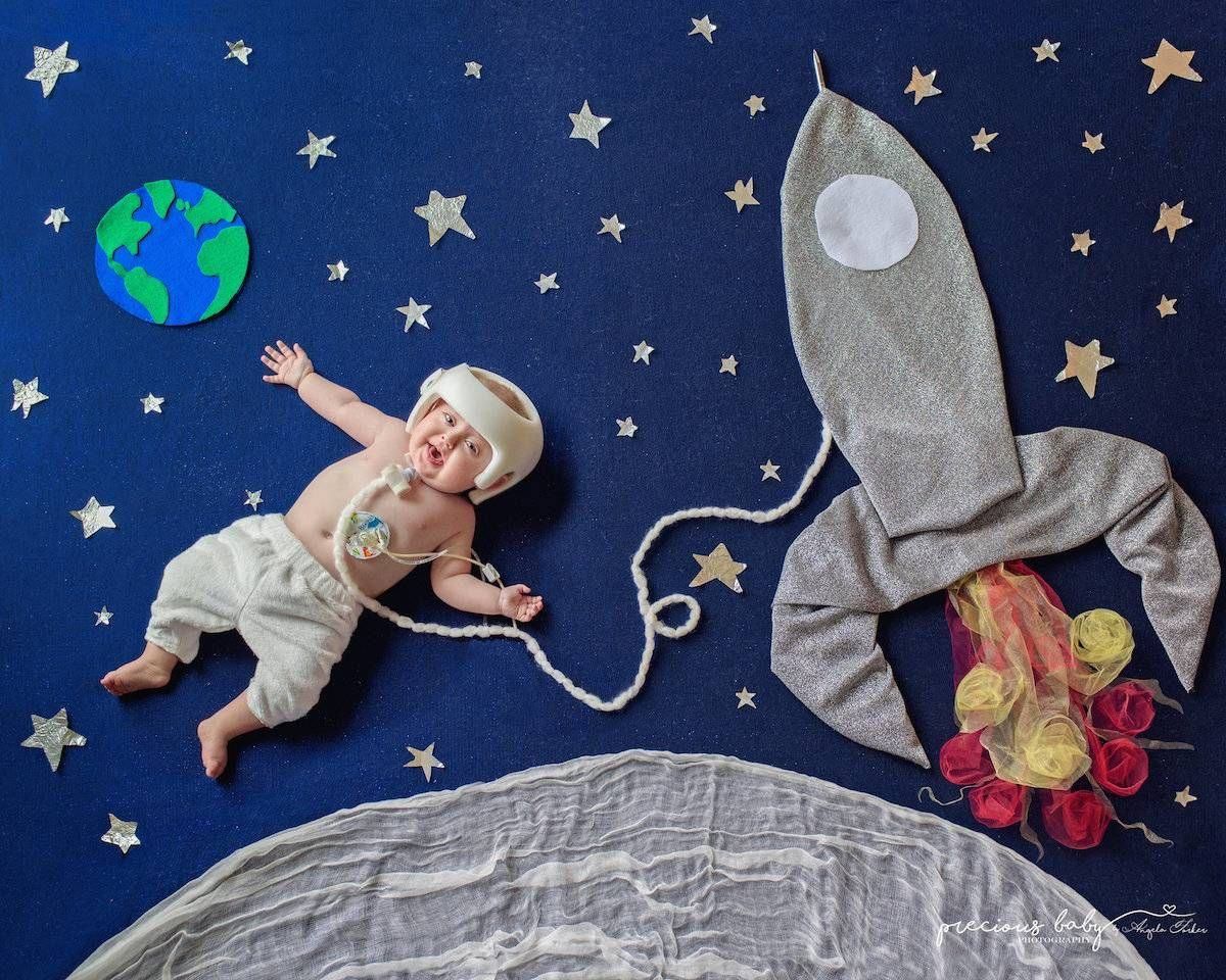 The Precious Baby Project: фото детей с серьезными заболеваниями The Precious Baby Project: фото детей с серьезными заболеваниями