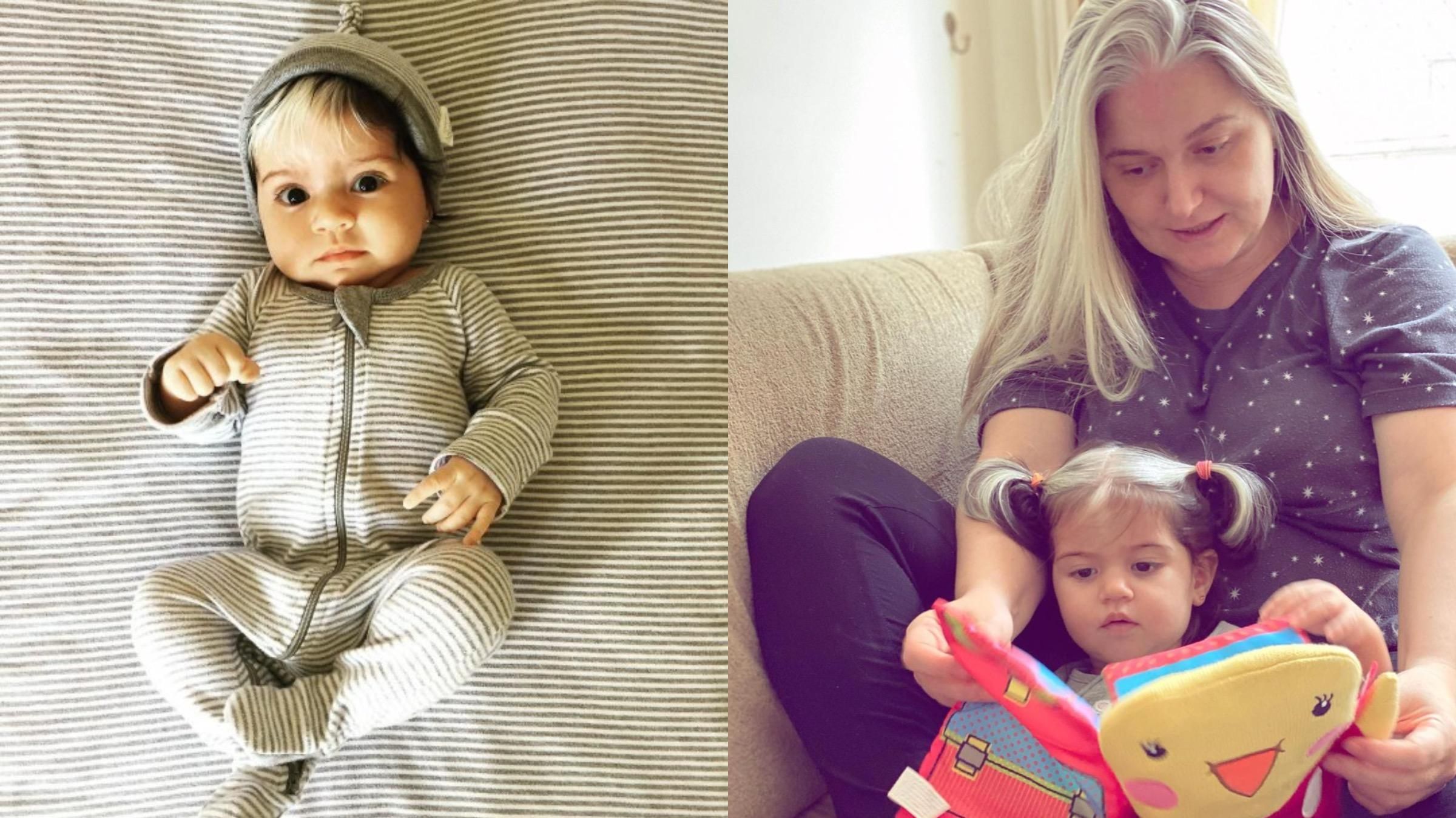 Девочка родилась с седыми волосами: фото Девочка родилась с седыми волосами: фото